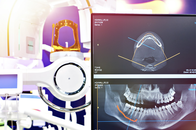 Digital X-Rays in Chicago